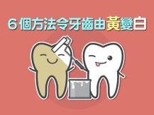 Teeth 6 個方法令牙齒由黃變白