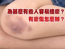 Bruises 為甚麼有些人容易撞瘀？有瘀傷怎麼辦？